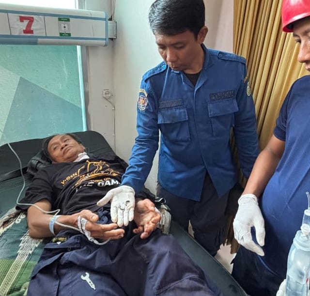 Jari Pasien RS Parepare Bengkak gegara Cincin Nyangkut, Dokter Panggil Damkar